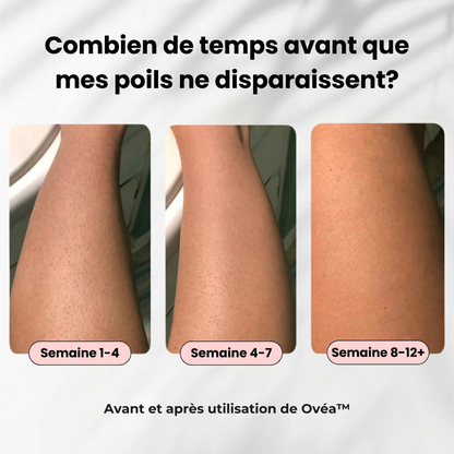 Épilateur Laser Ovéa™