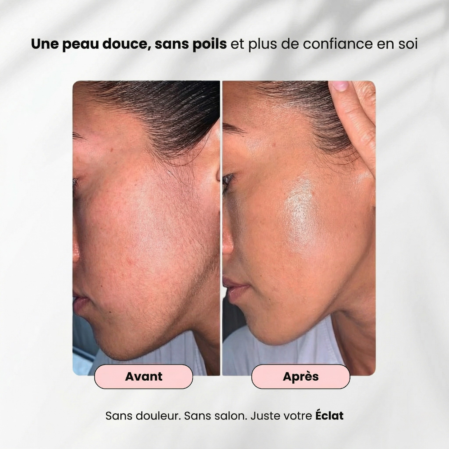Épilateur Laser Ovéa™