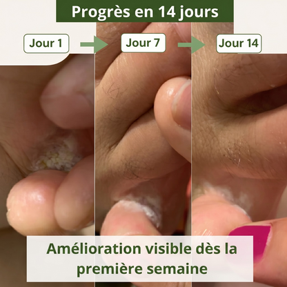 Savon Purifiant Actif